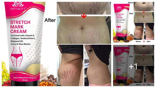 Unique Stretch Marks And Scars Creams & Oils