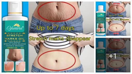 Useful Stretch Marks And Scars Creams & Oils