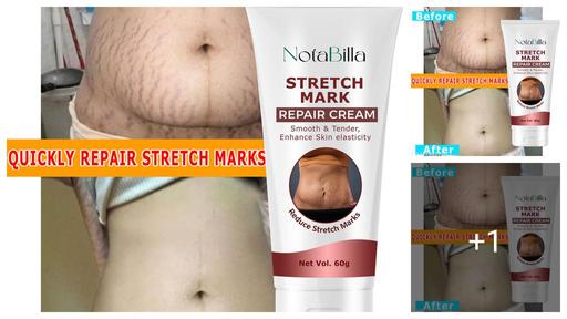 Everyday Stretch Marks And Scars Creams & Oils